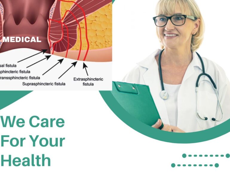 Fistula Causes, Symptoms, Treatment, and Prevention