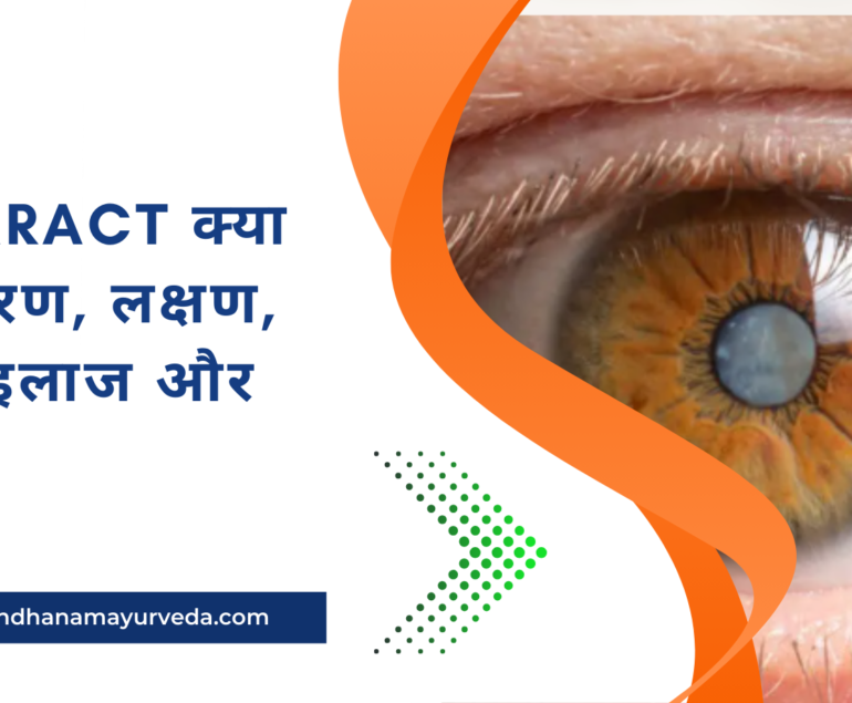 Cataract क्या है? कारण, लक्षण, जांच, इलाज और बचाव