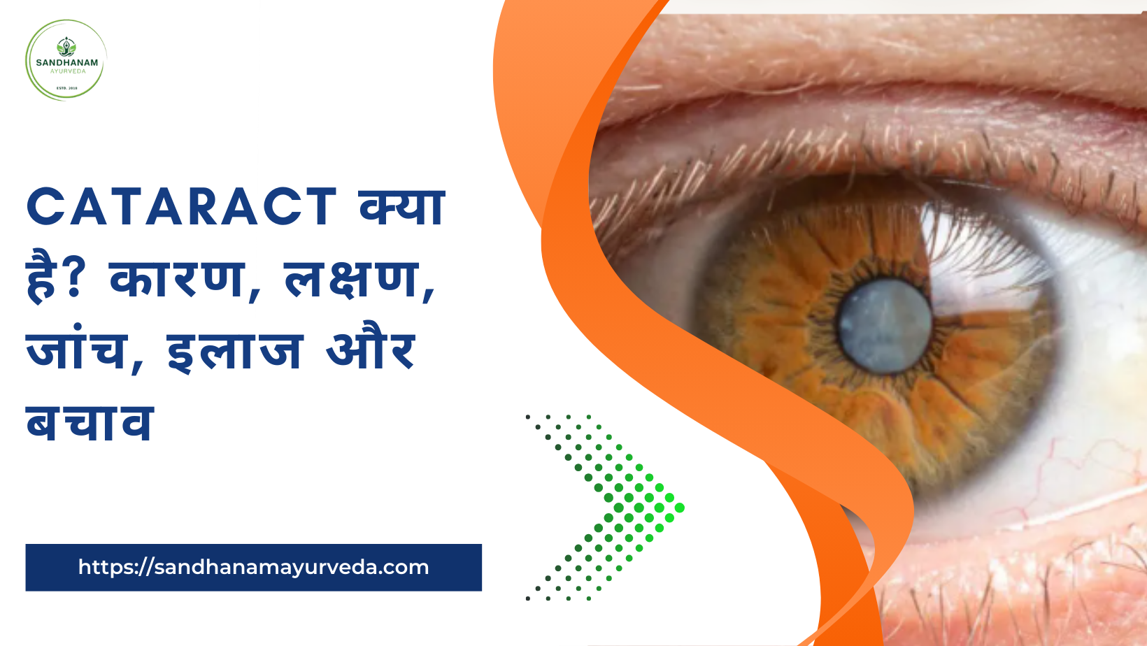 Cataract क्या है? कारण, लक्षण, जांच, इलाज और बचाव