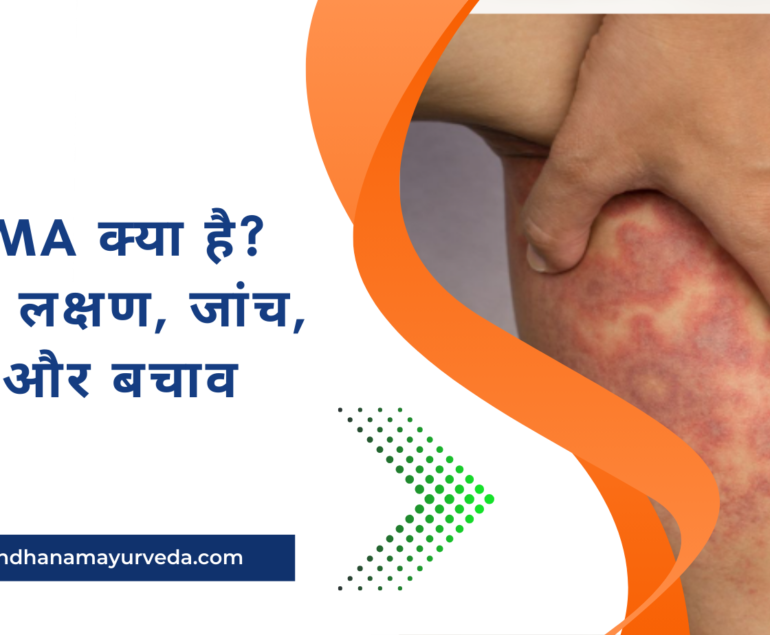 Eczema क्या है? कारण, लक्षण, जांच, इलाज और बचाव