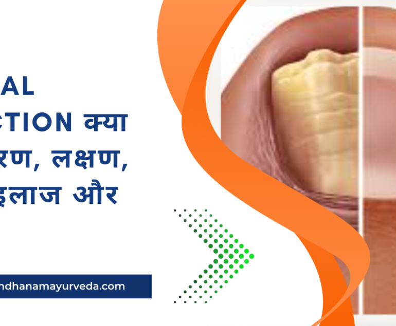 Fungal infection क्या है? कारण, लक्षण, जांच, इलाज और बचाव