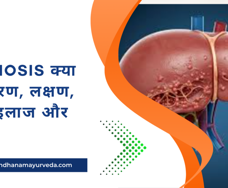 Liver cirrhosis क्या है? कारण, लक्षण, जांच, इलाज और बचाव