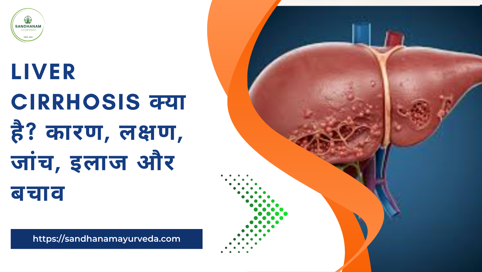 Liver cirrhosis क्या है? कारण, लक्षण, जांच, इलाज और बचाव