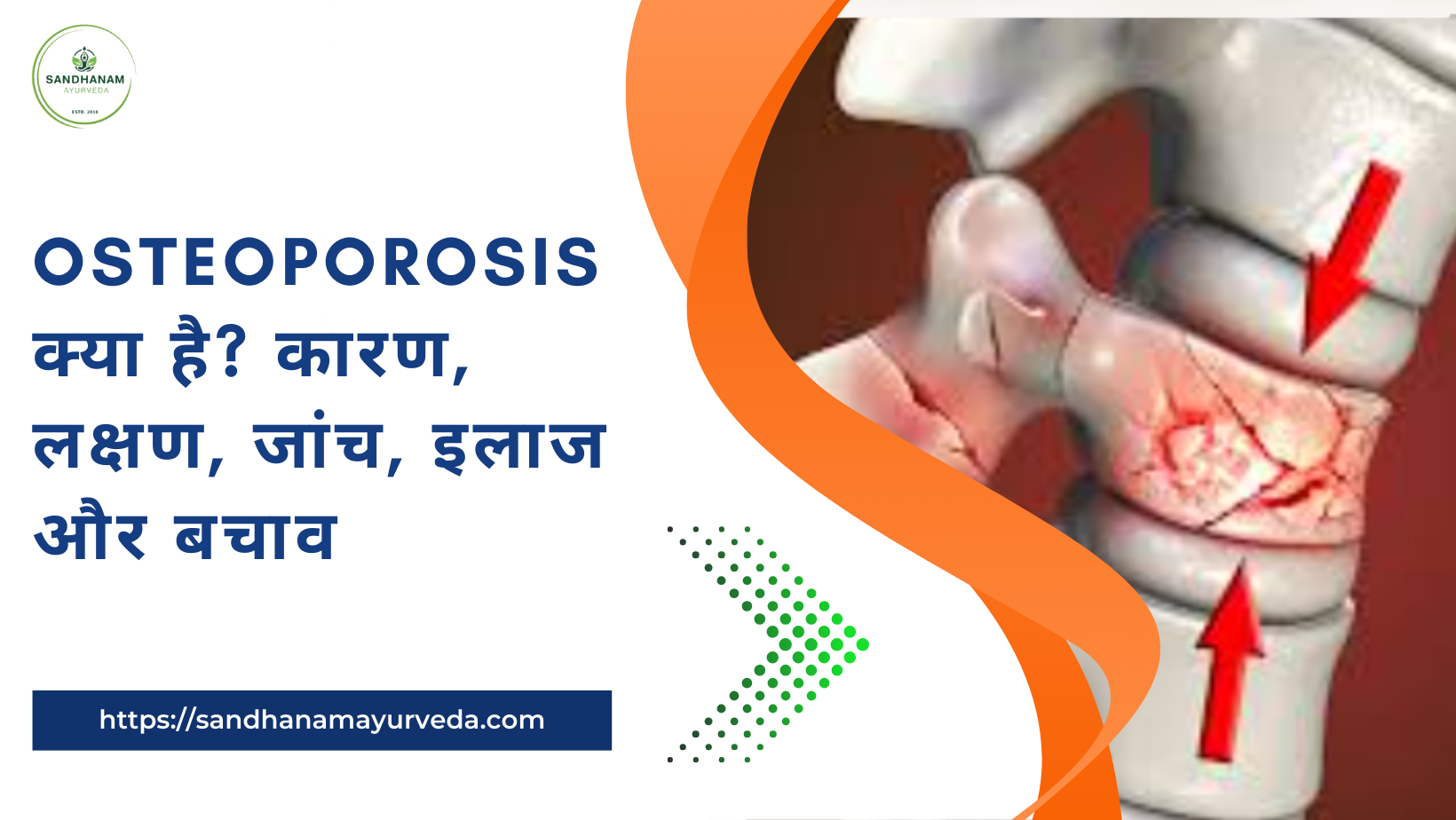 Osteoporosis क्या है? कारण, लक्षण, जांच, इलाज और बचाव
