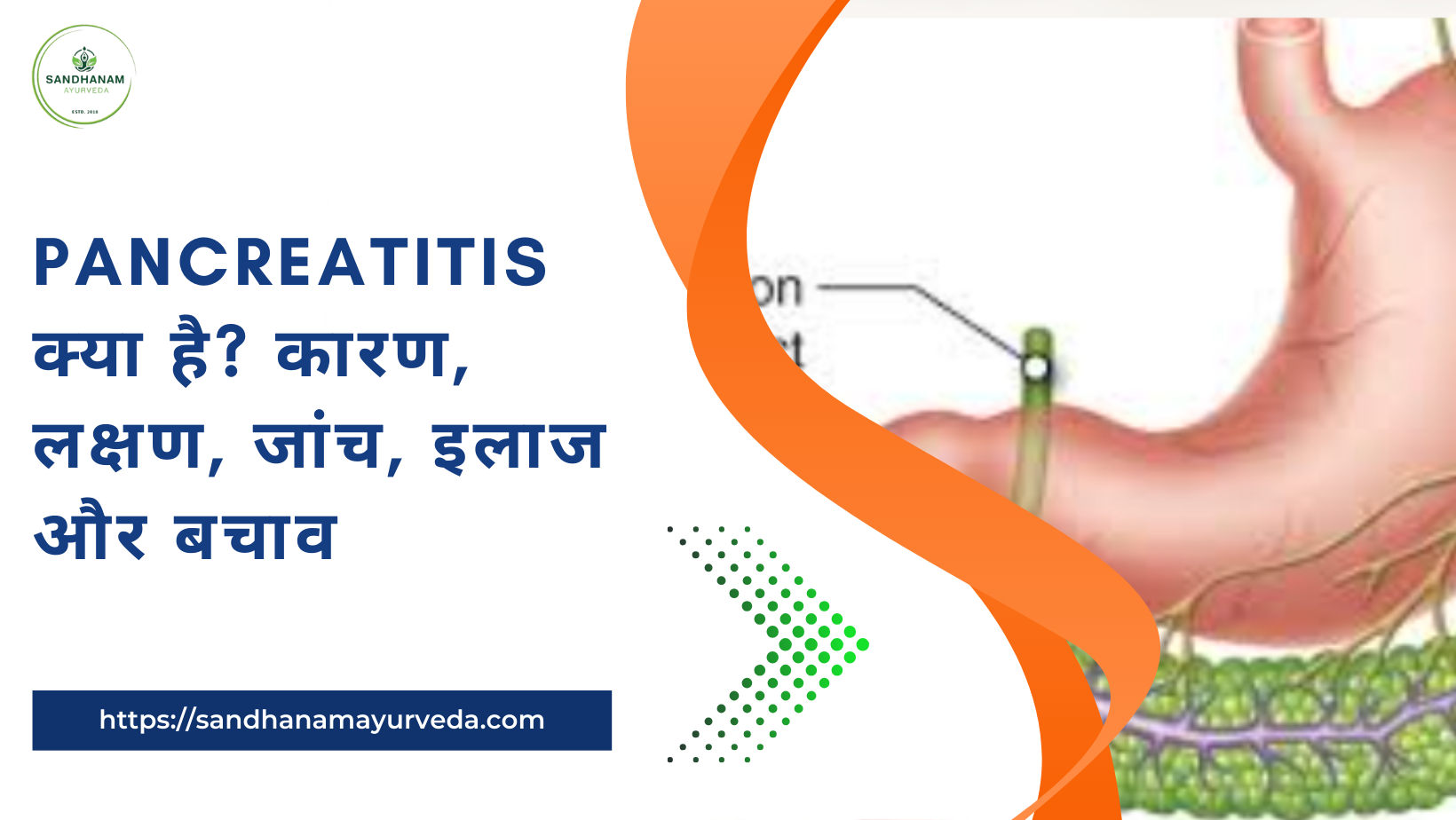 Pancreatitis क्या है? कारण, लक्षण, जांच, इलाज और बचाव