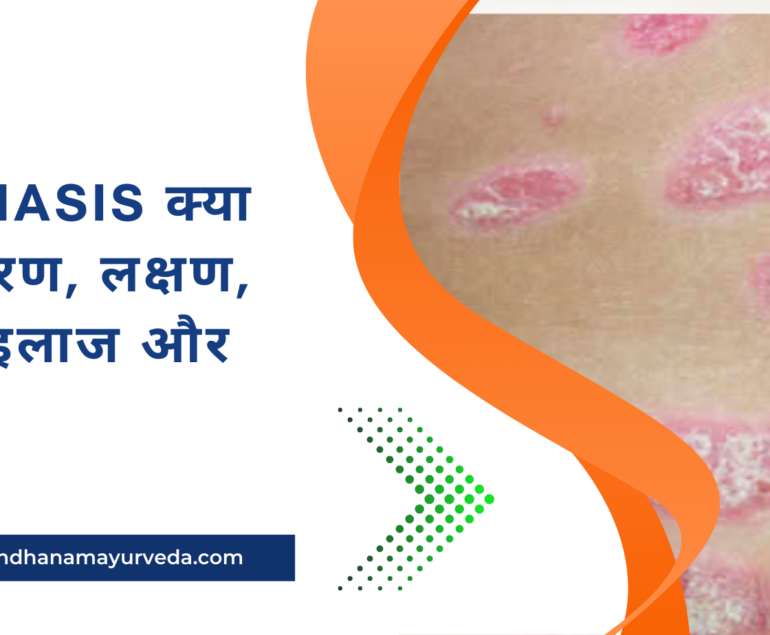 Psoriasis क्या है कारण, लक्षण, जांच, इलाज और बचाव