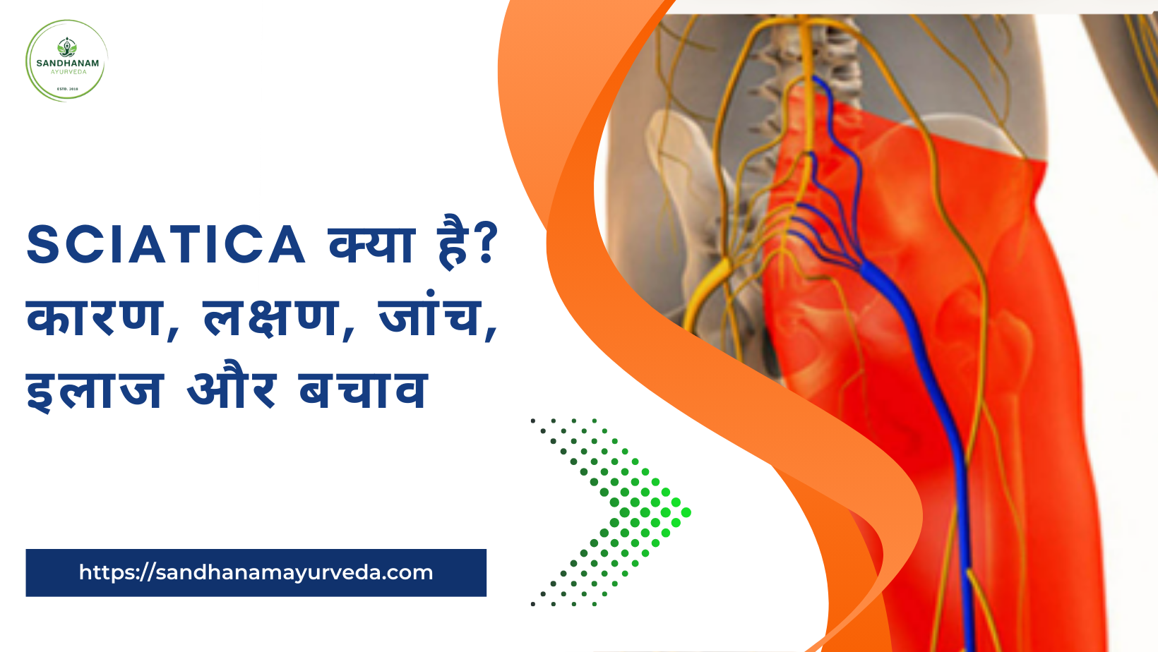 Sciatica क्या है? कारण, लक्षण, जांच, इलाज और बचाव